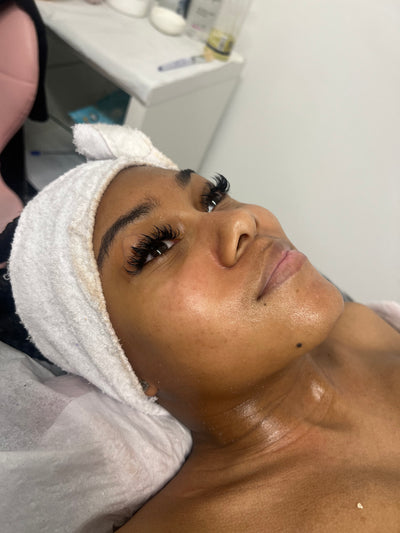 Facial Treatments
